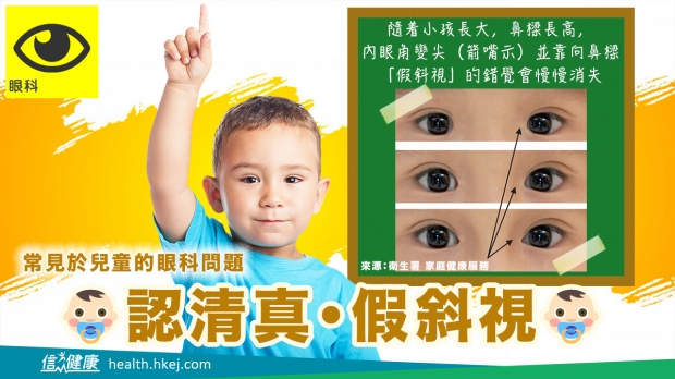 【訪問】信報：為何小孩常有假斜視問題？