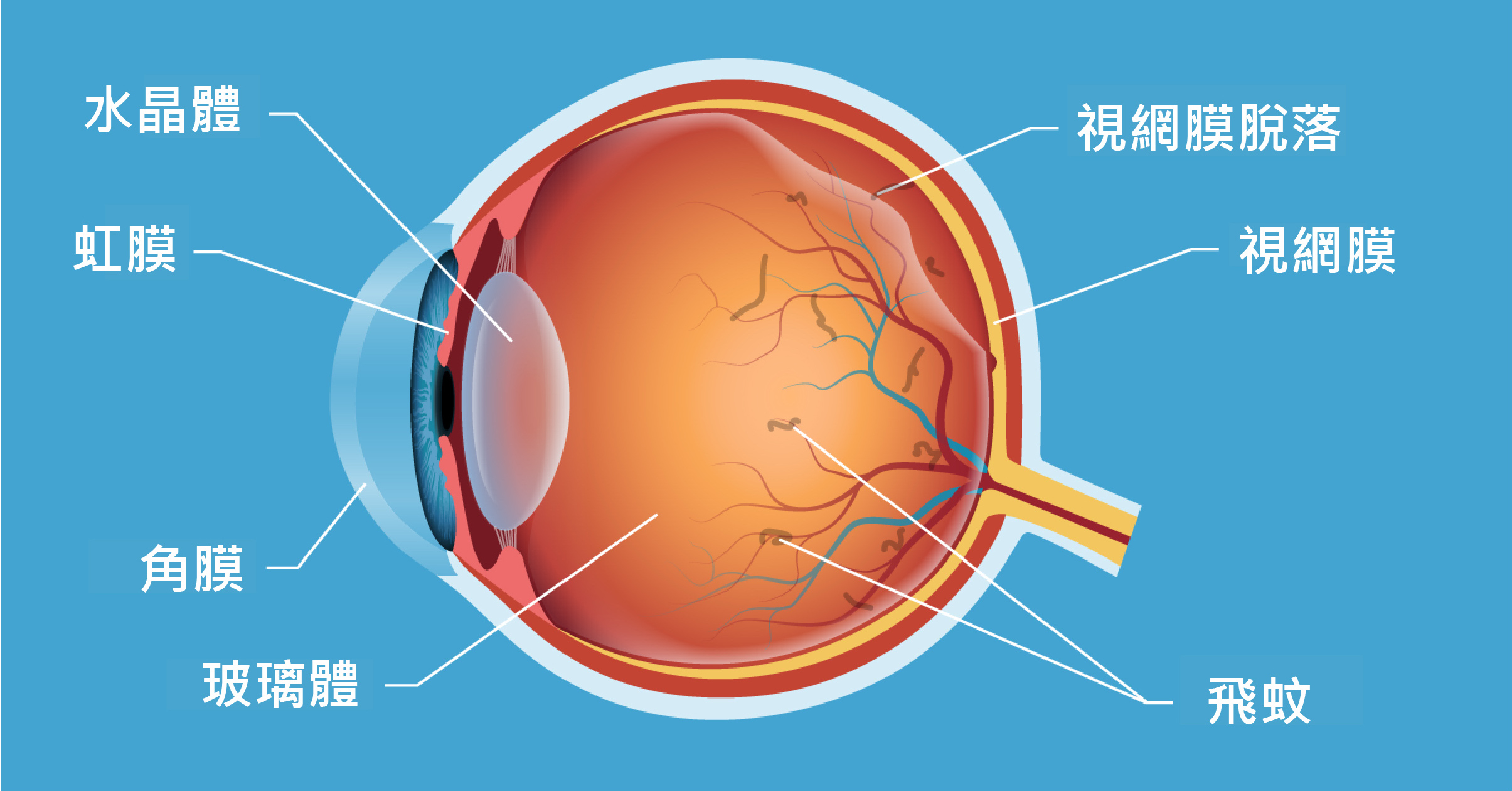 信報：玻璃體的病理