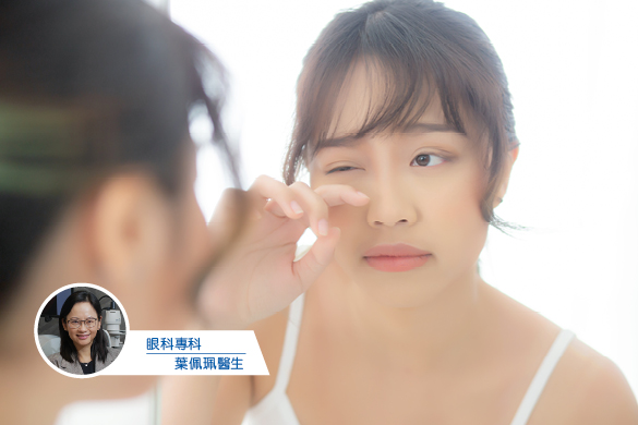 健康研究所：為何生眼瘡？ 預防眼瘡從生活習慣入手