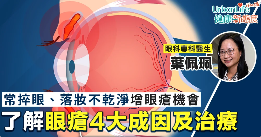 【訪問】UrbanLife：常捽眼、落妝不乾淨增眼瘡機會