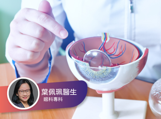 健康研究所：白內障手術後視力的變化及其人工晶體的注意事項