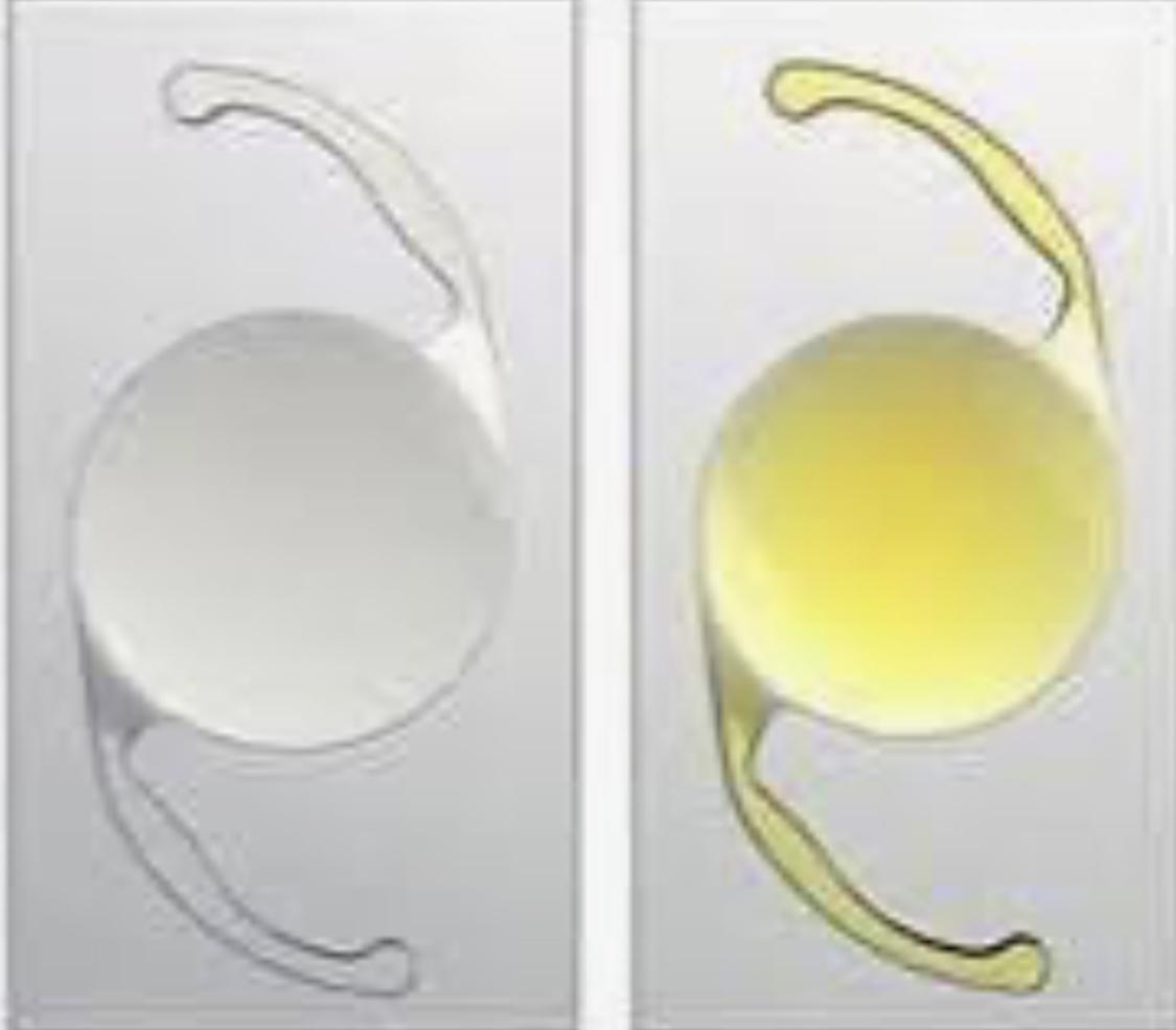 信報：白鏡與黃鏡